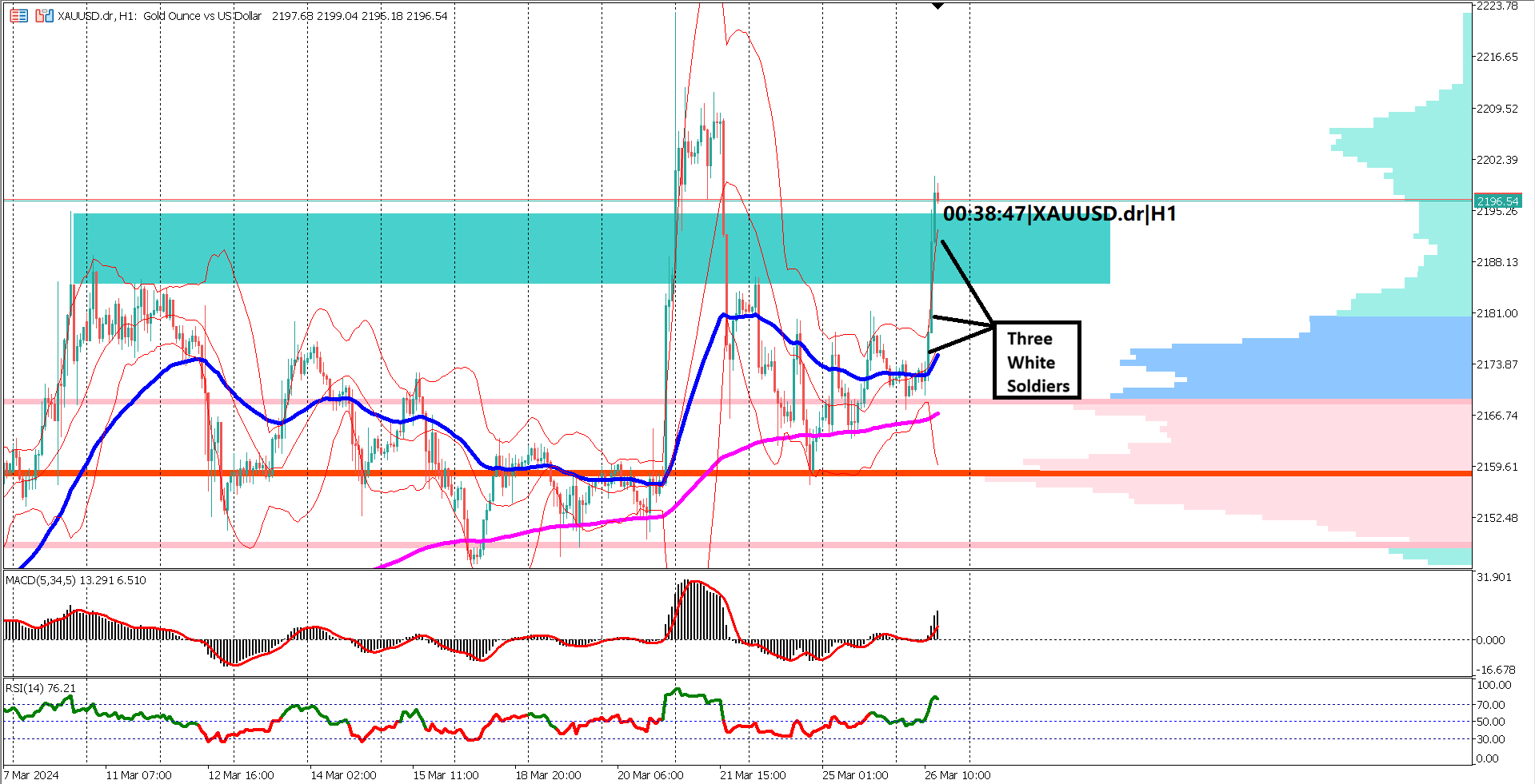 Economic Outlook: Gold Market Bullish as XAUUSD Breaks Resistance Levels