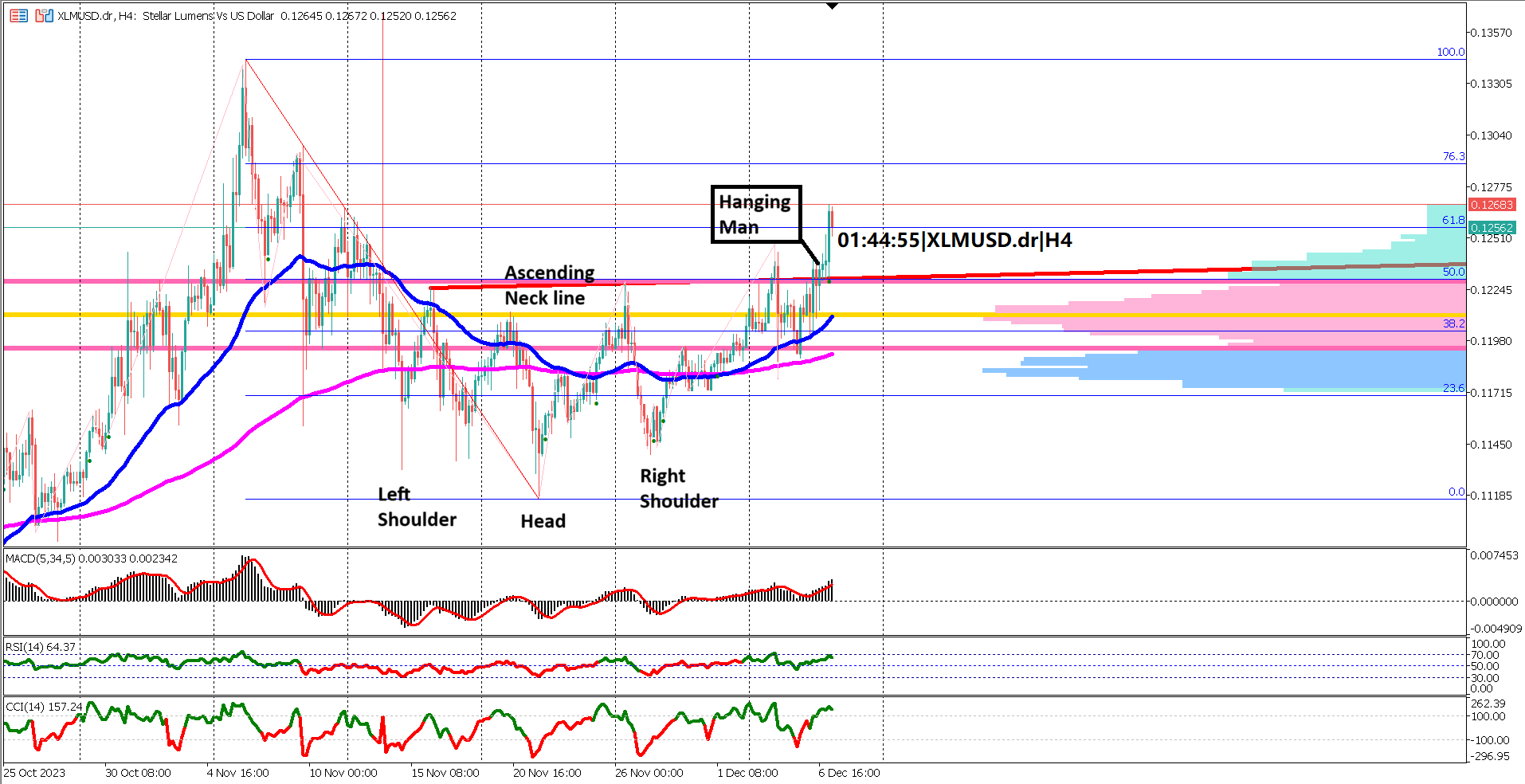 XLMUSD: Navigating Bullish Waters with Inverse Head and Shoulders Breakout