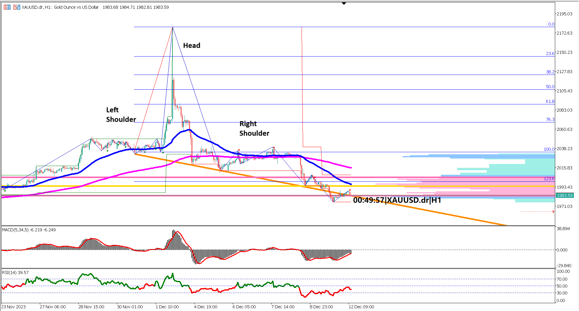 XAUUSD Bears in Focus: Analyzing the Head and Shoulders Break Amidst US Core CPI Release