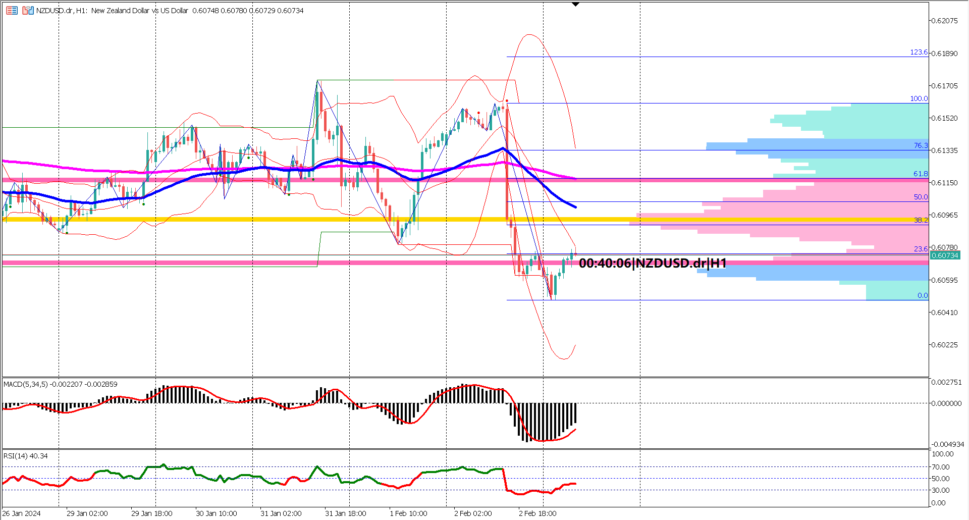  Unmasking NZDUSD's Plunge: How Last Week's US Data Sparked a 1.2% Drop!