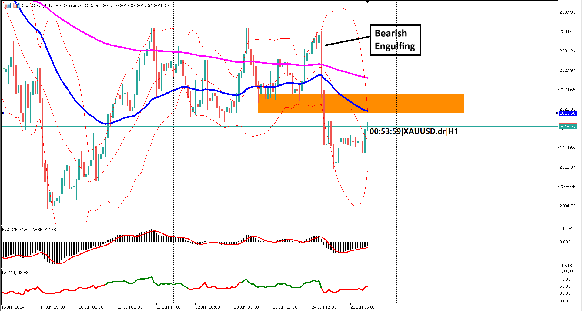 Gold Dances with Data: Will US GDP Spark a Reversal?