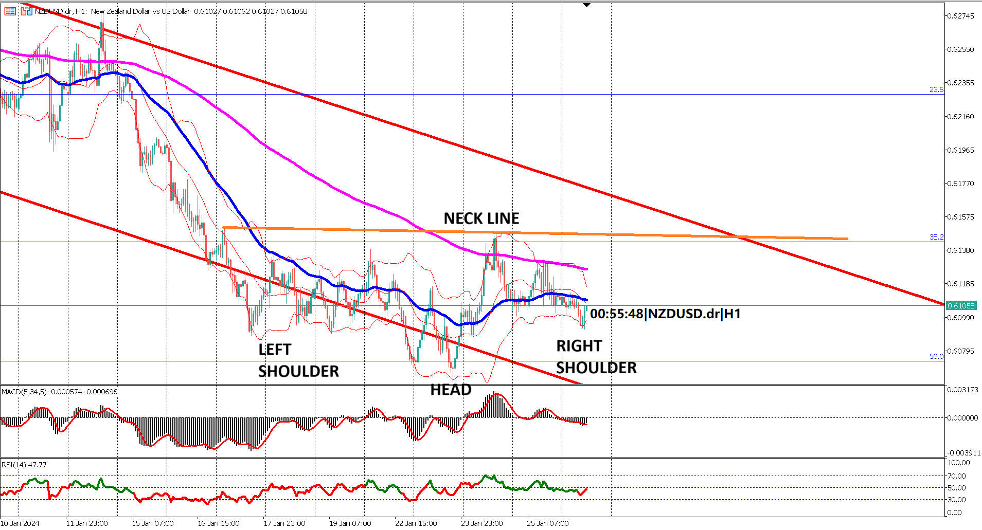 Navigating NZDUSD: Inverted Head and Shoulders in Focus After US GDP Surprise